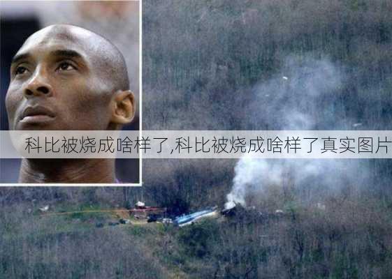科比被烧成啥样了,科比被烧成啥样了真实图片