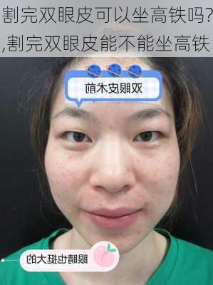 割完双眼皮可以坐高铁吗?,割完双眼皮能不能坐高铁